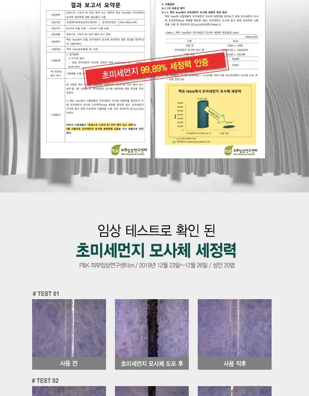 [갓생살다_탈모옴] 포레스트스토리 B7 안티 헤어 로스 헤어팩 200ml 상세페이지 6